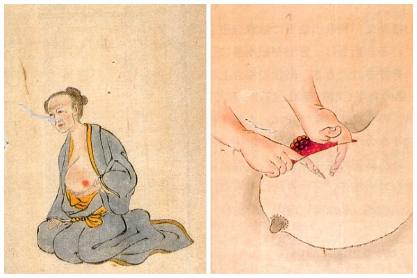 История медицины — анатомия в Японии 7